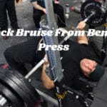 Back Bruise From Bench Press